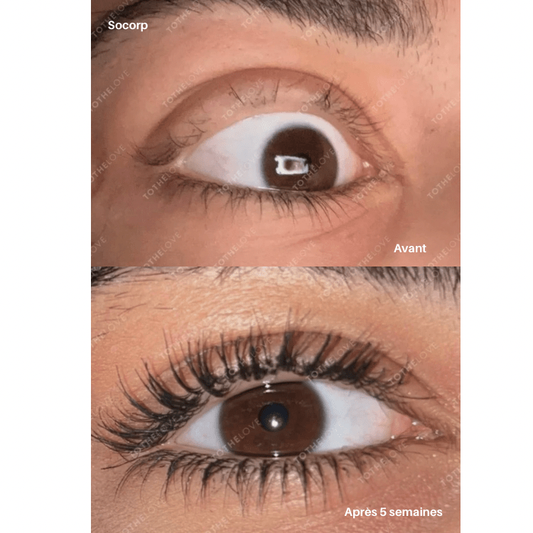 tothelove Sérum tothelash Sérum tothelash - TOTHELOVE