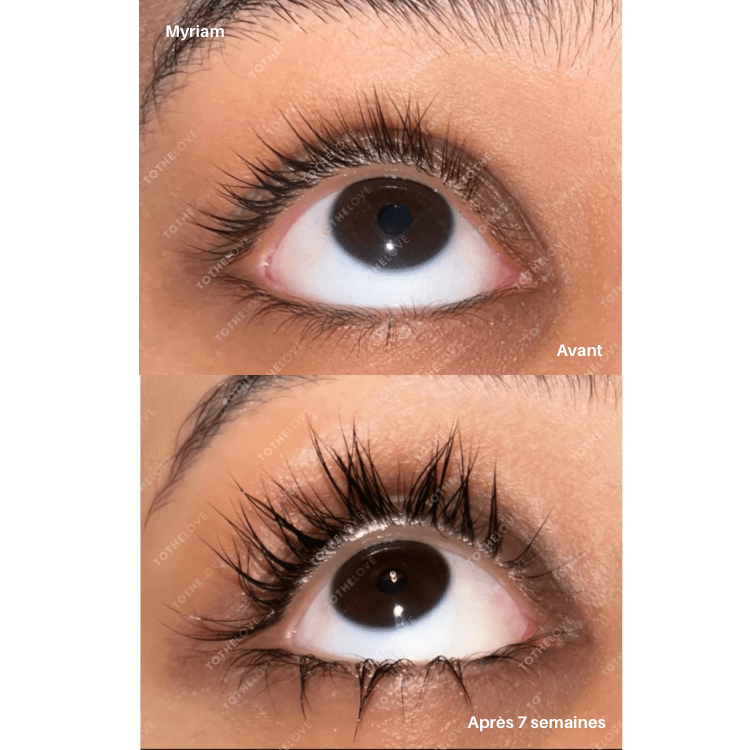 tothelove Sérum tothelash Sérum tothelash - TOTHELOVE