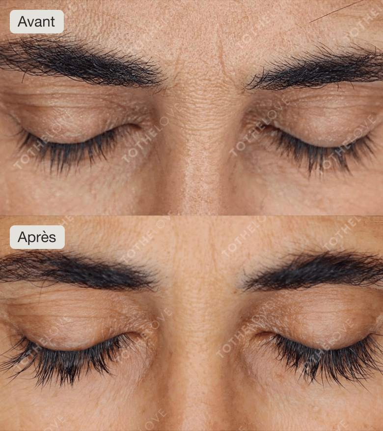 Meilleur sérum pour cils clairsemés et fins